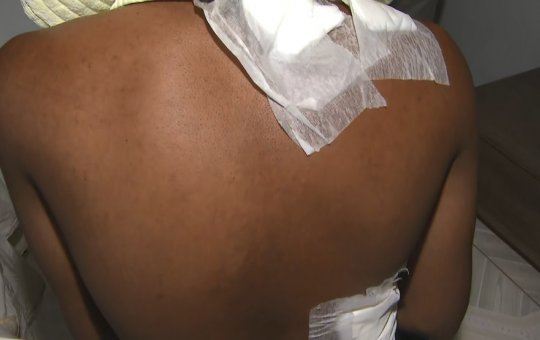 Mototaxista é esfaqueado e roubado por homem que fingiu ser cliente em Salvador