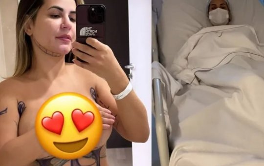 Deolane Bezerra passa por nova cirurgia de lipoaspiração