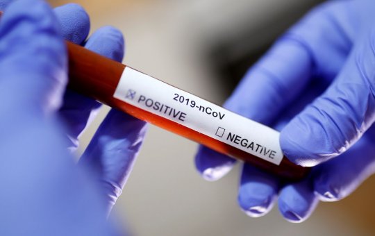 Dobra número de pessoas diagnosticadas com Covid-19 em agosto
