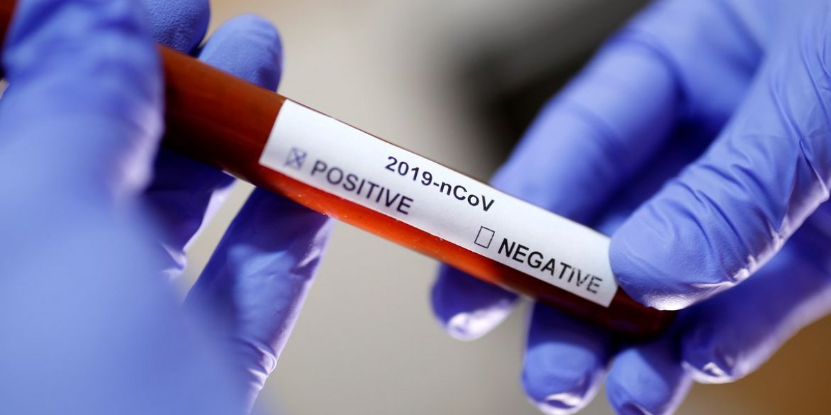 Dobra número de pessoas diagnosticadas com Covid-19 em agosto