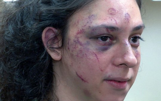 Porteiro que viu agressão a Victor Meyniel é autuado por omissão de socorro