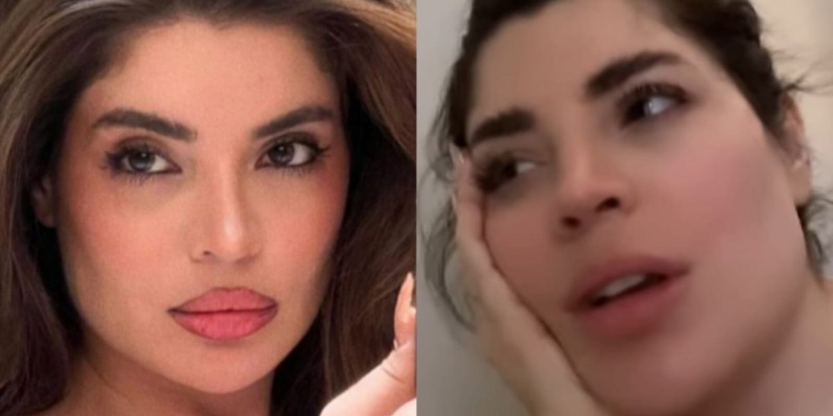 Gkay desabafa sobre harmonização facial: "Não tinha ninguém para avisar"