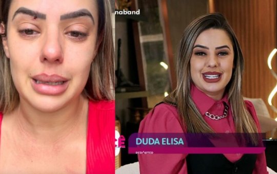 Repórter da Band denuncia agressão pelo ex-marido e atual namorada