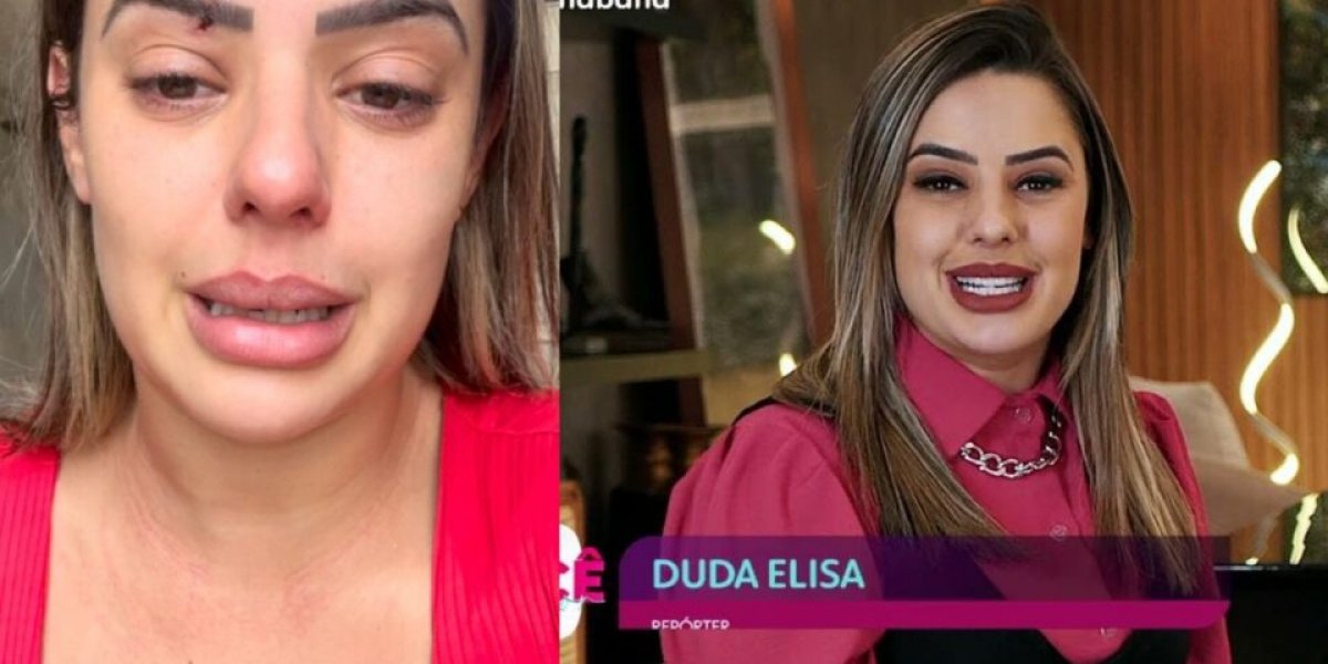 Repórter da Band denuncia agressão pelo ex-marido e atual namorada