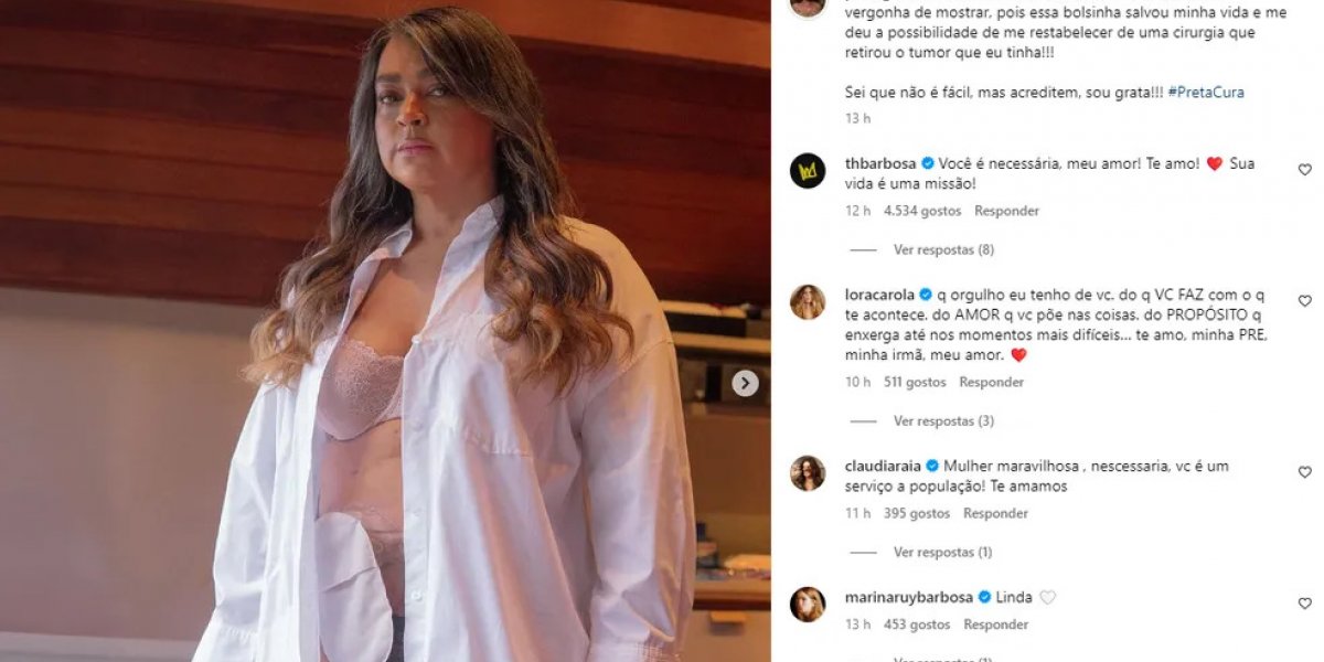 Bolsa de Ileostomia aparece em primeira foto de Preta Gil