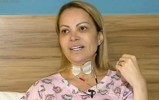 Cantora Solange Almeida diz que uso de cigarro eletrônico prejudicou sua voz