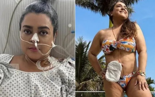 Preta Gil mostra evolução na reabilitação com fisioterapia