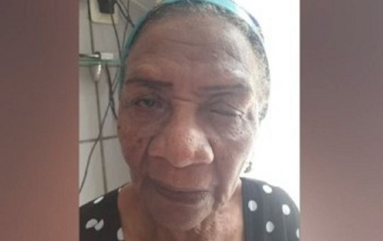 Cinco pacientes ficam cegos após cirurgia de catarata pelo Hapvida