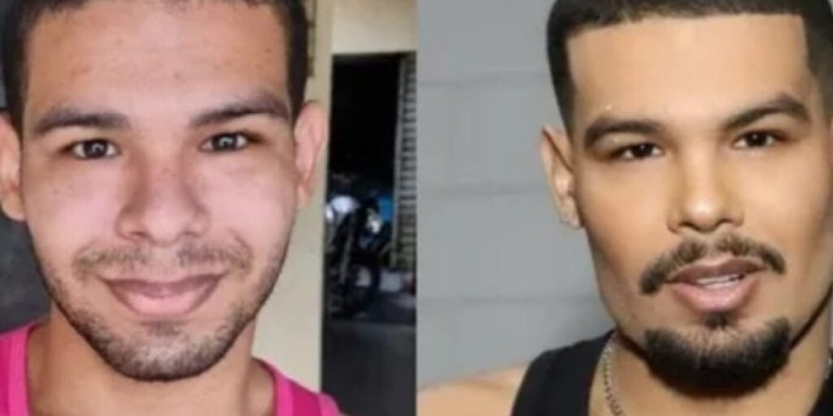 Vyni retruca críticas na web, após harmonização facial