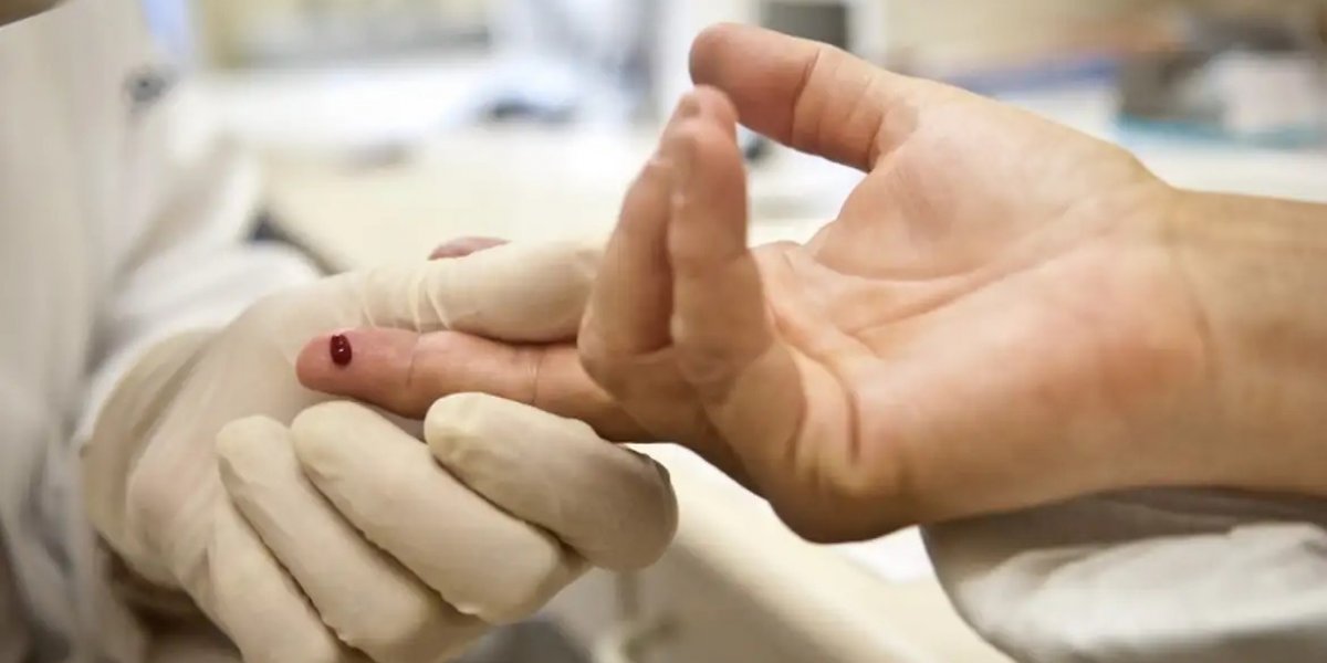 Casos de sífilis e de HIV/aids aumentam entre homens jovens