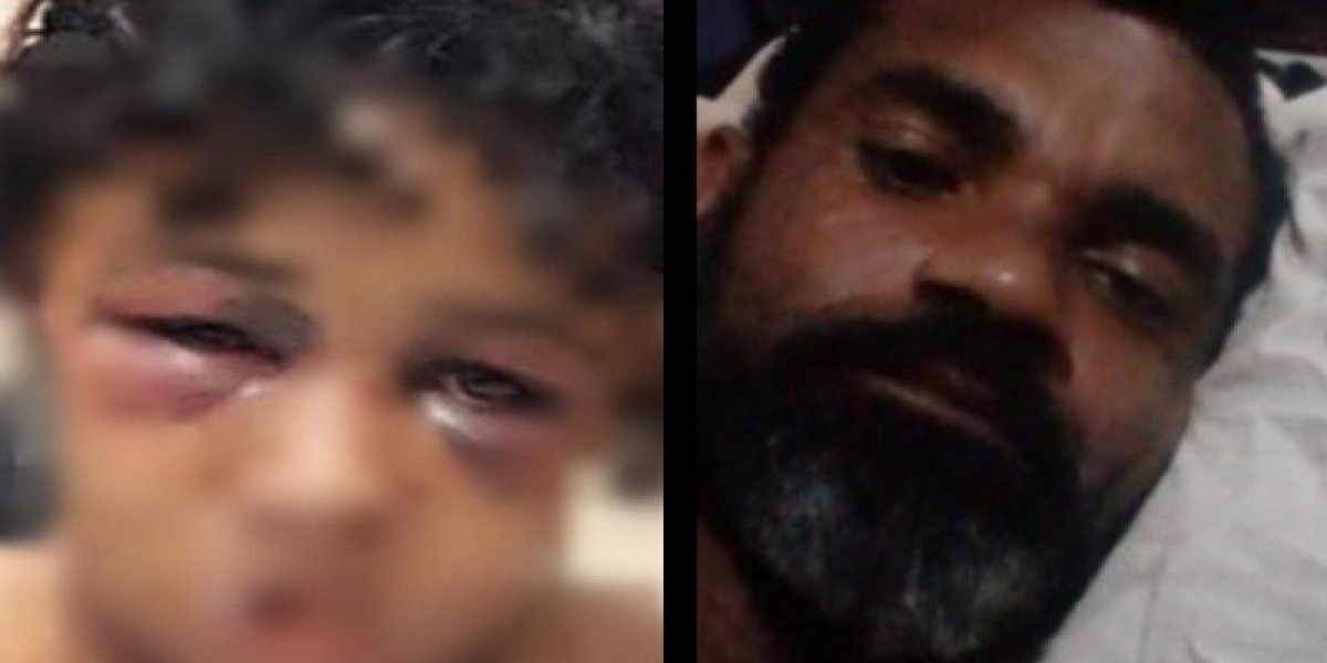 Homem que espancou e queimou rosto de companheira é preso em Salvador