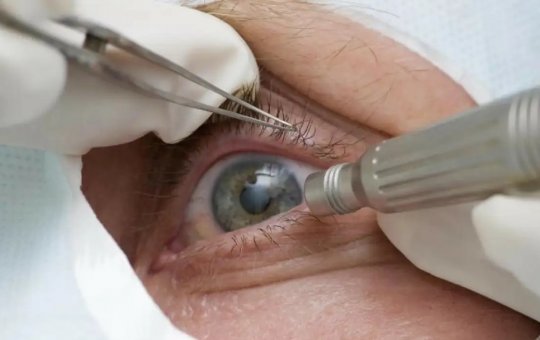 Médicos alertam para riscos de cirurgia de mudança da cor dos olhos