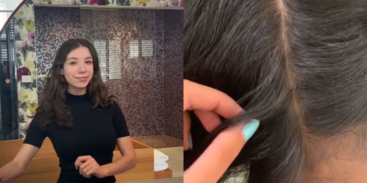 Mulher Australiana ganha dinheiro catando piolhos e lêndeas