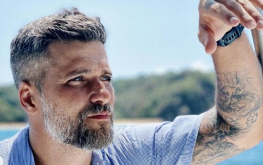 Ficou careca? Ator da globo surpreende ao mostrar visual diferente; veja