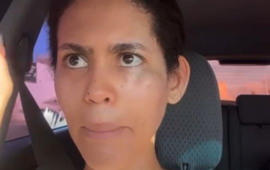 Dentista é assaltada e agredida no Largo das Baianas em salvador