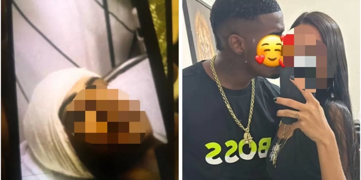 Mulher tem cabeça raspada e baleada por suspeito em Mata Escura