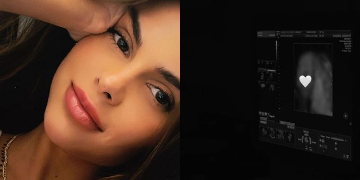 Modelo que estaria grávida de Neymar revela foto da filha em ultrassom