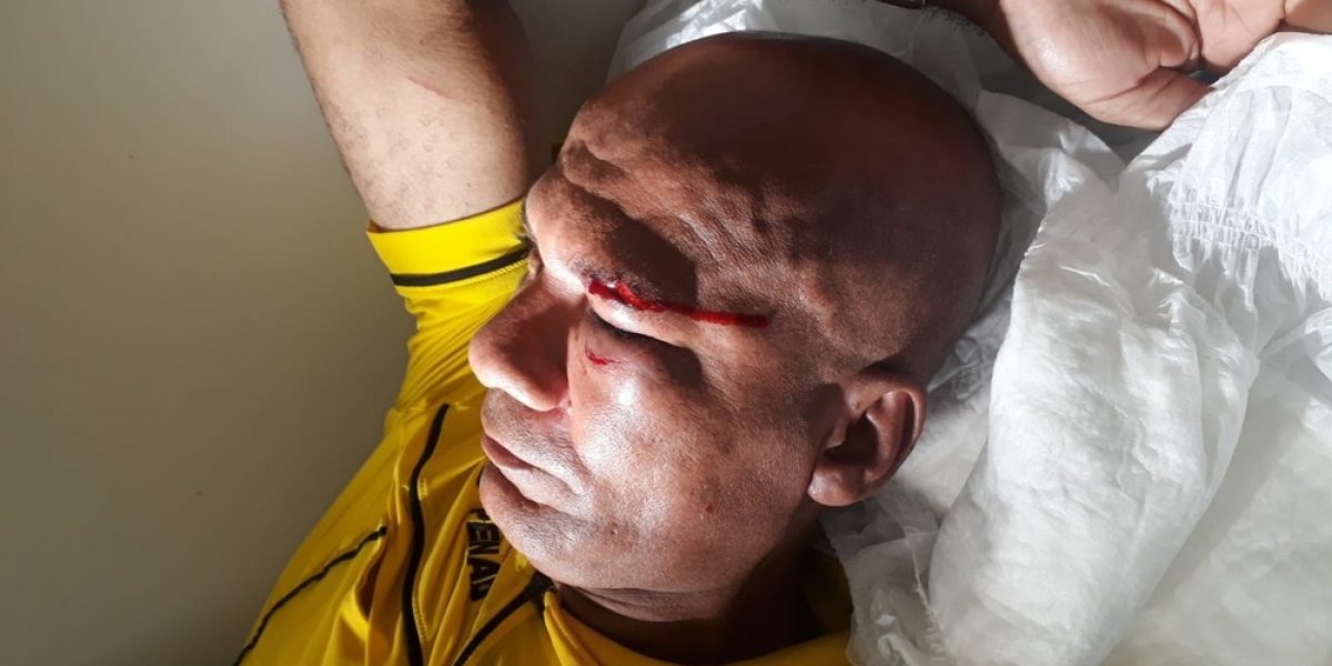 Árbitro é agredido com soco após expulsão em campeonato no interior do estado
