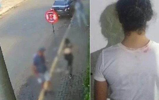 Mulher é presa por atacar jovem com ácido por ciúmes do ex-marido