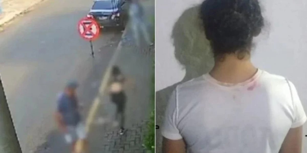 Mulher é presa por atacar jovem com ácido por ciúmes do ex-marido