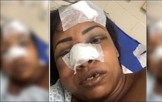 Mulher trans é agredida por traficantes na Fazenda Grande do Retiro