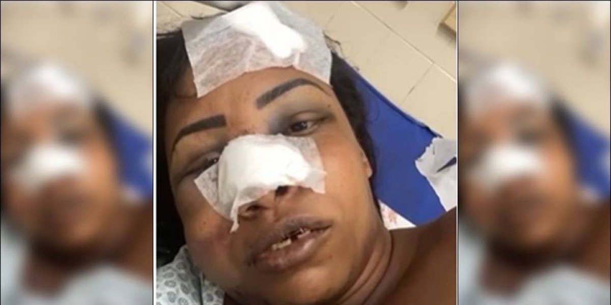 Mulher trans é agredida por traficantes na Fazenda Grande do Retiro