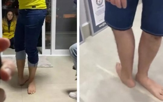 Brasileiro entra para o Guinness World Records por girar o pé em 210 graus