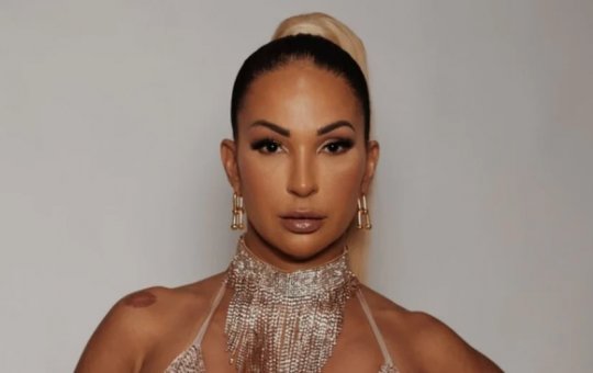 Valesca Popozuda afirma quase ter amputado parte da perna após hidrolipo