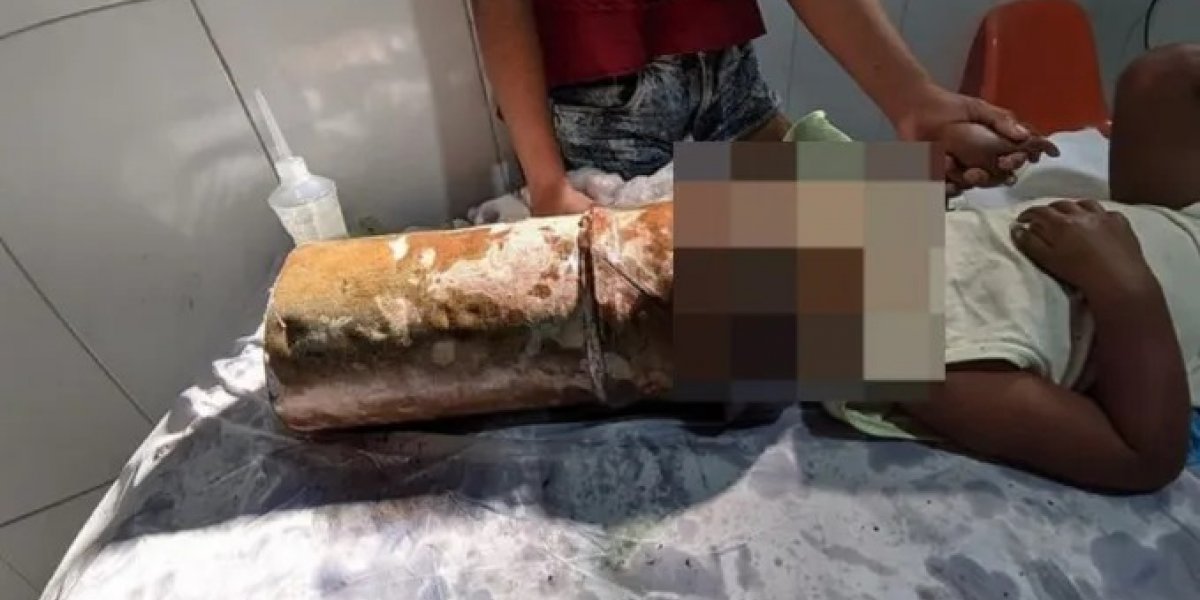 Criança de 2 anos prende tubo na cabeça e causa desespero em populares