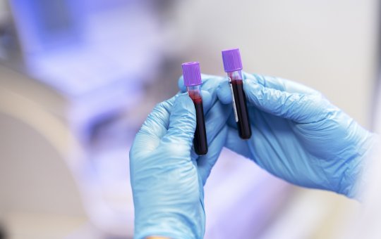 DNA: Barradão e Fonte Nova terão exame gratuito; saiba mais