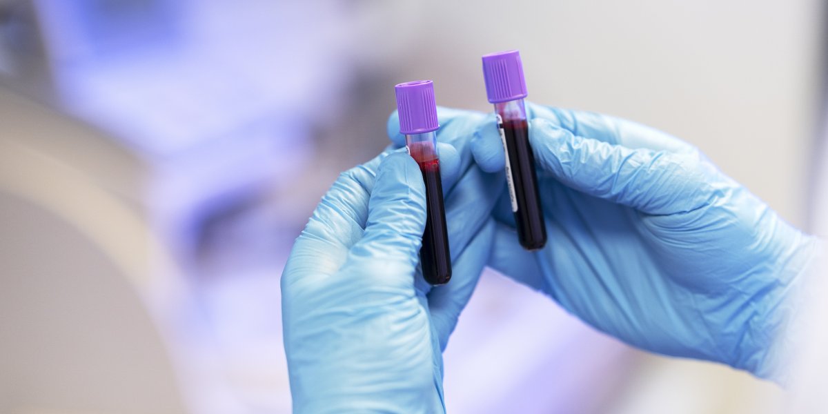 DNA: Barradão e Fonte Nova terão exame gratuito; saiba mais