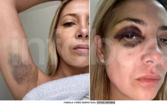 Ex-primeira-dama da Argentina acusa ex-presidente Alberto Fernández de agressão