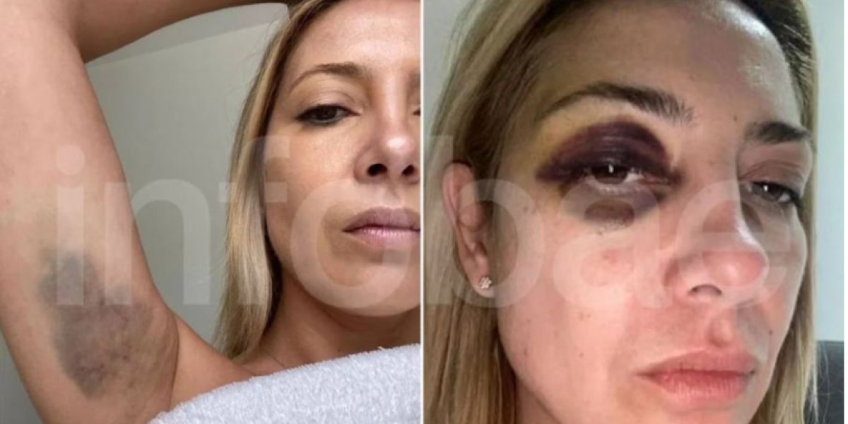 Ex-primeira-dama da Argentina acusa ex-presidente Alberto Fernández de agressão