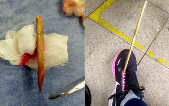 Mulher é atingida por flecha em Belo Horizonte