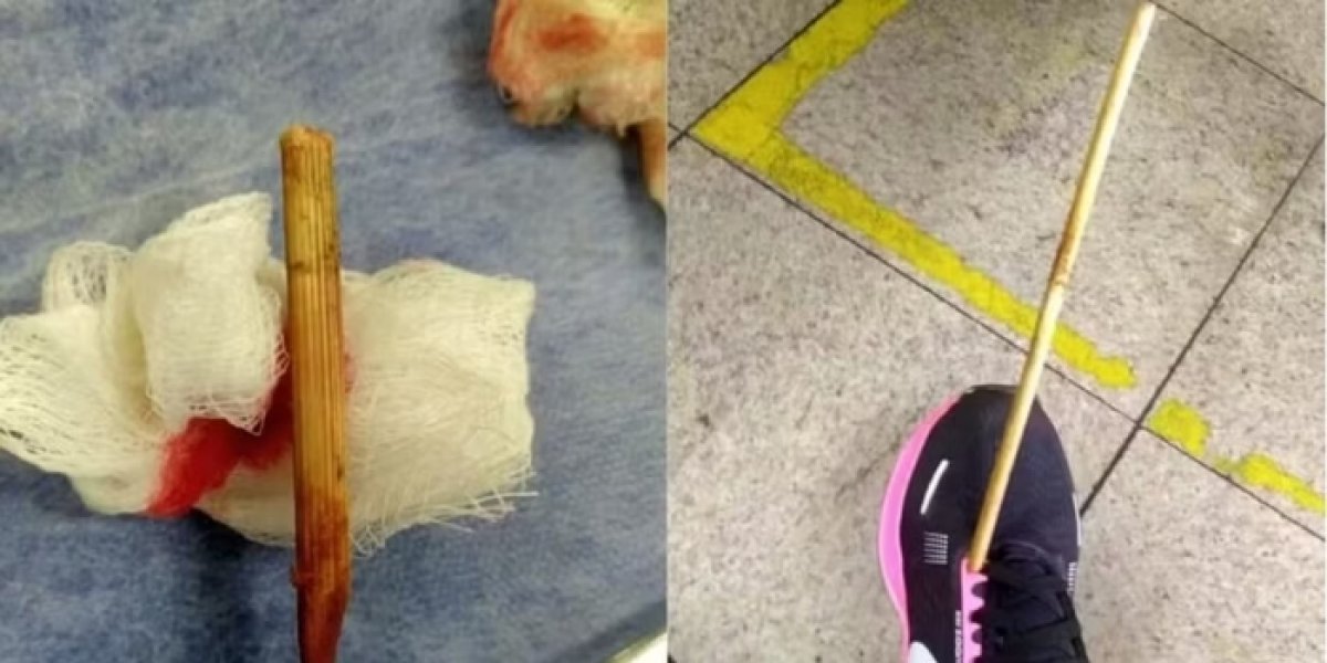 Mulher é atingida por flecha em Belo Horizonte