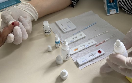 Nova variante do HIV é identificada na Bahia e outros estados brasileiros