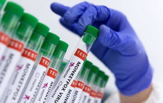 Anvisa apura casos de mpox e isola imigrantes retidos em aeroporto