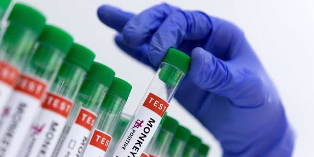 Anvisa apura casos de mpox e isola imigrantes retidos em aeroporto