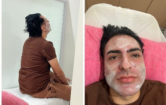 Peeling de Fenol: Esteticista vira ré por homicídio após morte de paciente