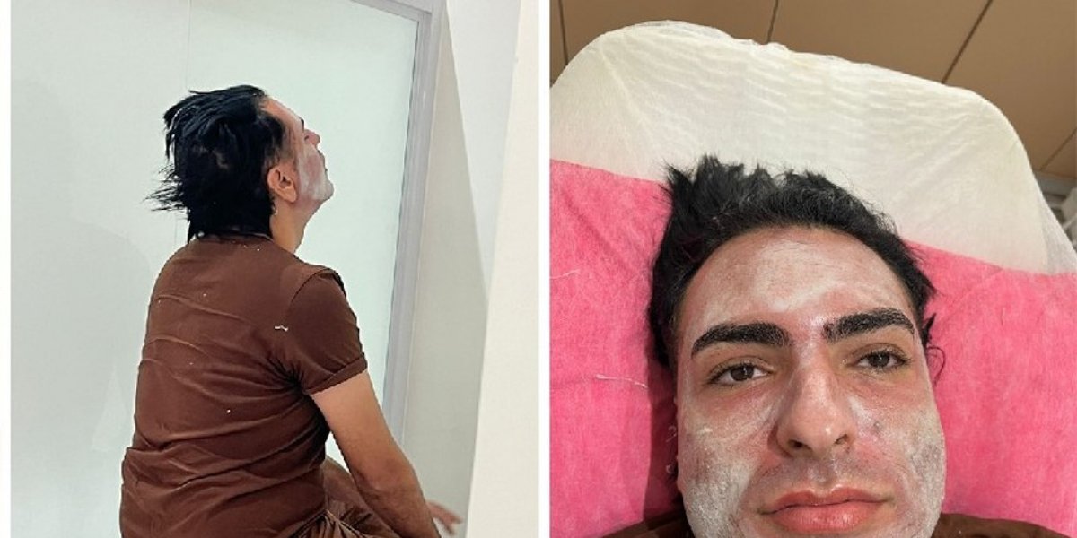 Peeling de Fenol: Esteticista vira ré por homicídio após morte de paciente