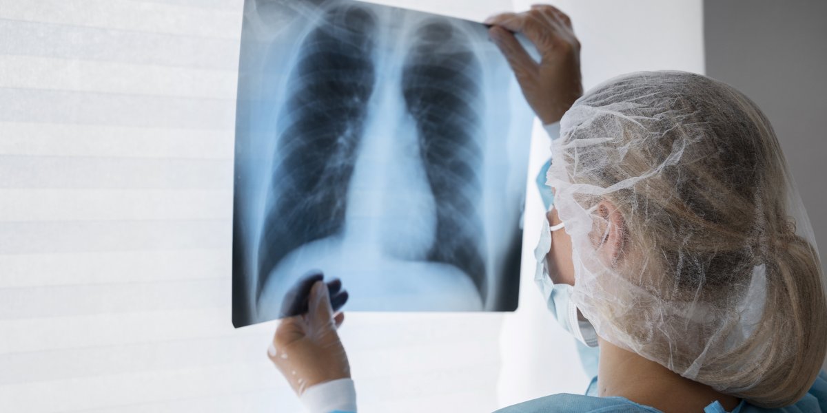 Estudo aponta crescimento do câncer de pulmão em 65% no Brasil até 2040; confira