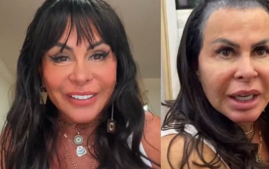 Gretchen choca a web ao aparecer sem prótese capilar: 'Perdi todo o cabelo'