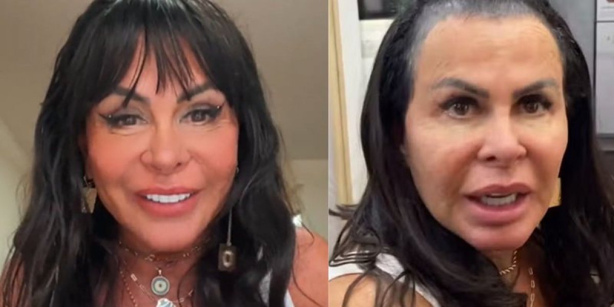 Gretchen choca a web ao aparecer sem prótese capilar: 'Perdi todo o cabelo'