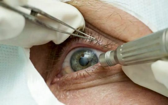 MP diz que infecção em cirurgias de olhos aconteceu por falha na higienização
