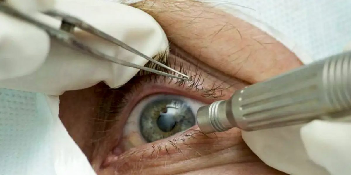 MP diz que infecção em cirurgias de olhos aconteceu por falha na higienização