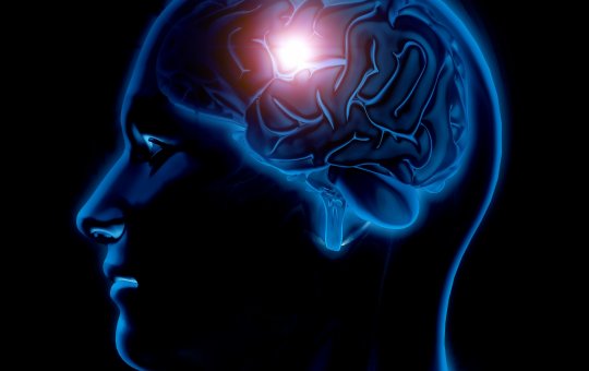 Dia Mundial do Acidente Vascular Cerebral; saiba mais