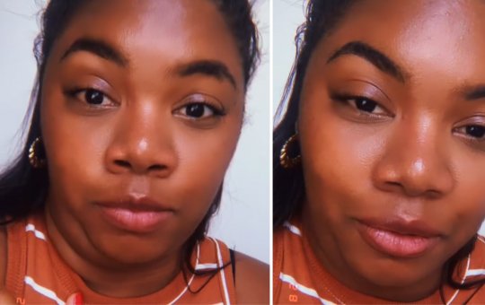 Após bateria de exames, Raquel Brito atualiza seguidores sobre estado de saúde