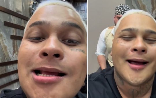 Mc Ryan SP mostra como são seus dentes após retirar lentes