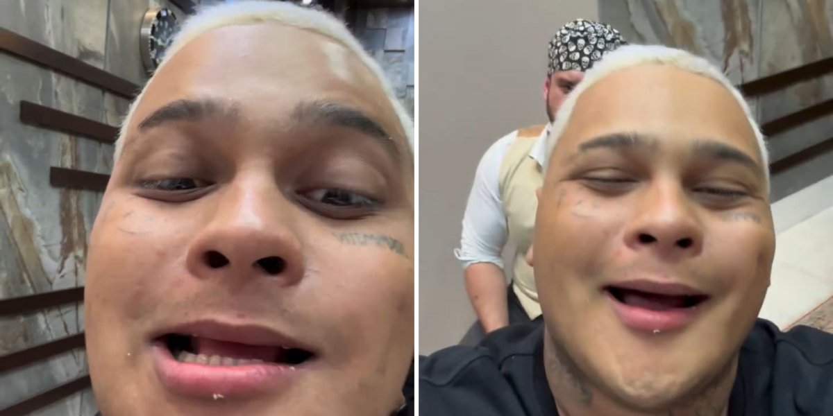 Mc Ryan SP mostra como são seus dentes após retirar lentes