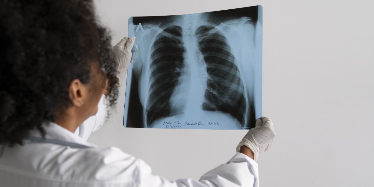 Dia Nacional de Combate à Tuberculose: dados da Bahia alerta para Importância do Tratamento Completo